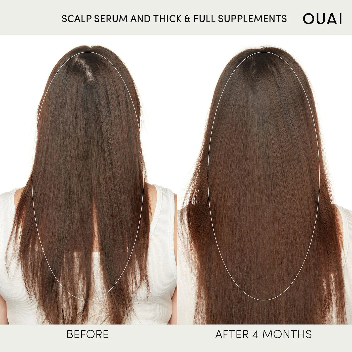 OUAI Hydrating Scalp Serum for Healthy, Fuller Looking Hair